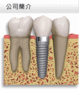 人工牙根系統植牙體系